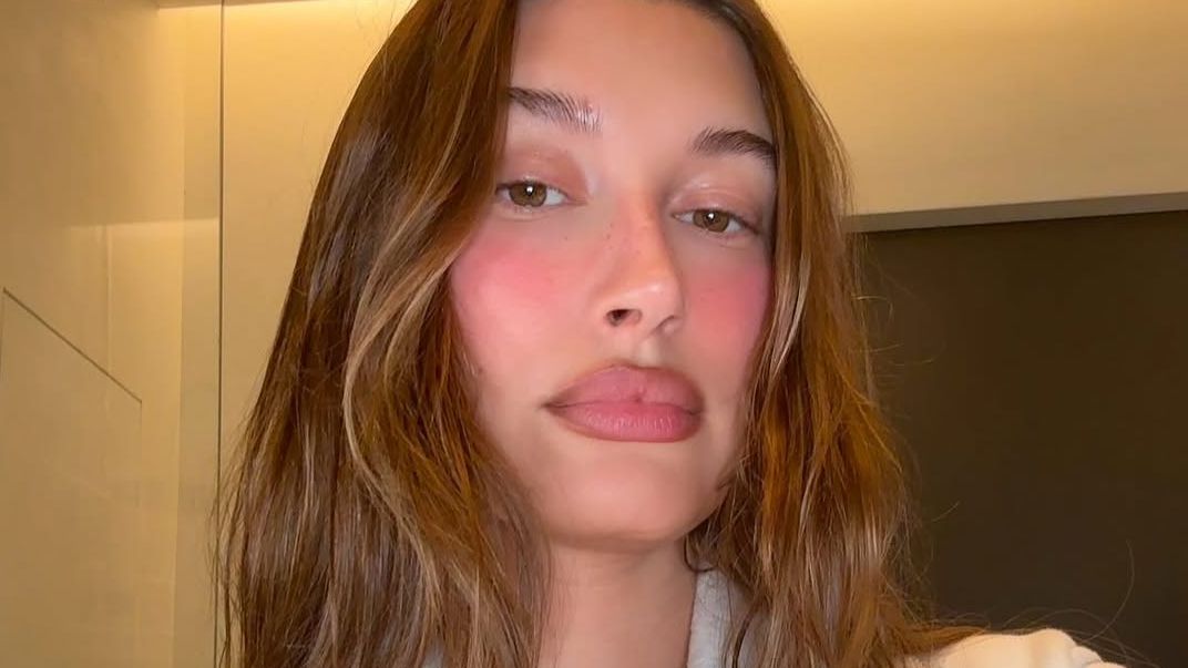 Hailey Bieber gets candid about her dermatitis flare-ups and how she treats them